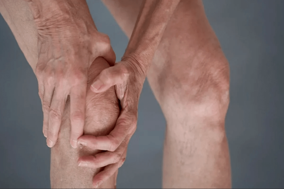 joint pain can be a cause of arthrosis or arthritis