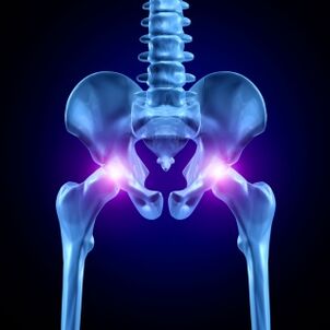 Pain in the hip joint can be acute, painful or chronic