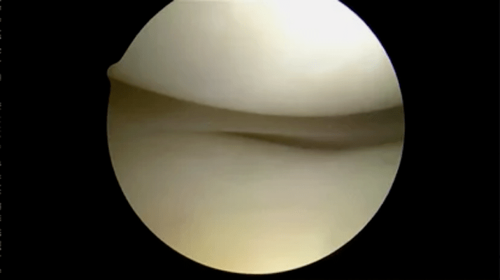 astroscopic view of a completely healthy surface