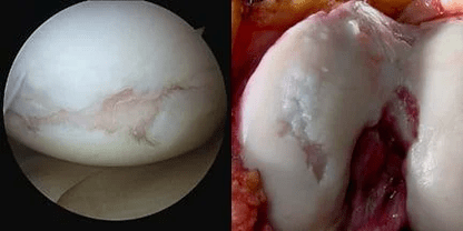 surface image of the knee joint