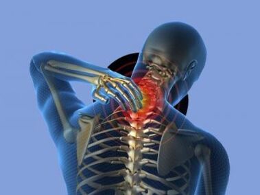 A person suffering from osteochondrosis of the cervical spine is disturbed by neck pain